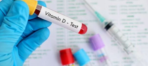 vitamin-d-testing-market-730x430